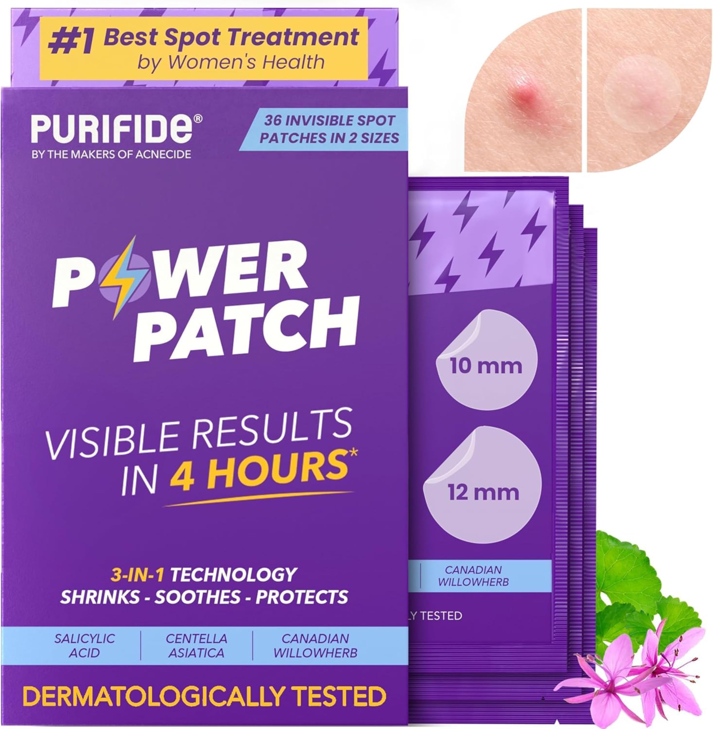 Acnecide - Purifide Power Pimple Patches (36 Count)