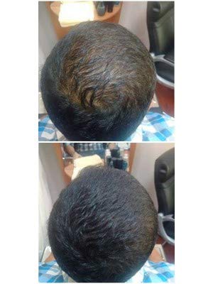 Nanogen Hair Fibres - Dark Brown, 30 g | Keratin Hair Thickener | Unisex